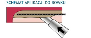 Wklejanie dodatkowego wzmocnienia spiralnego do rowku w murze